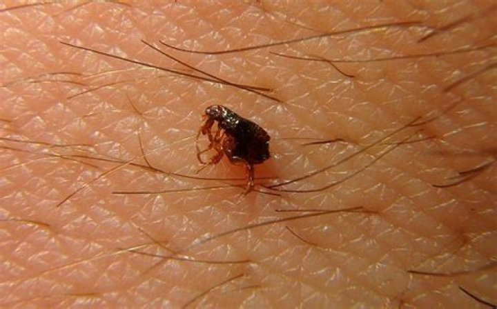 Can Dog Fleas Live In Human Hair