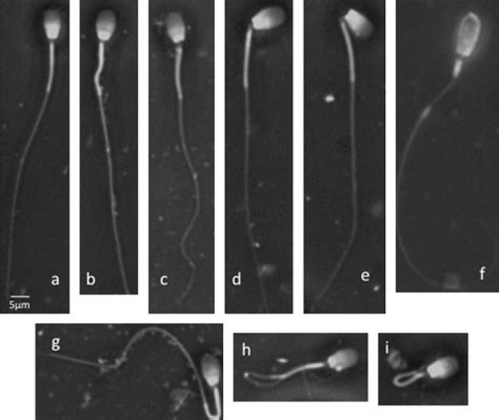 How Long Does Dog Sperm Live In A Female
