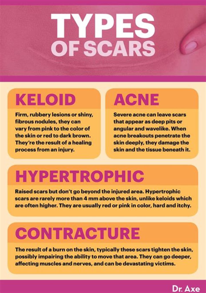 Question: How To Get Rid Of Scab Scars On Legs