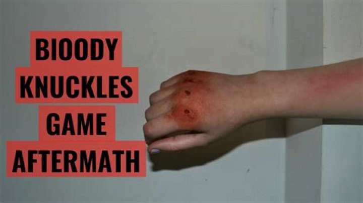 Quick Answer: How To Play Bloody Knuckles