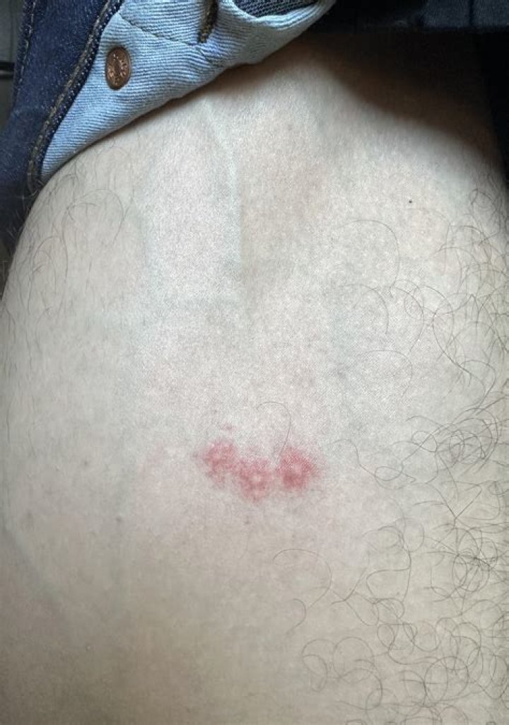 What Bites In A Straight Line
